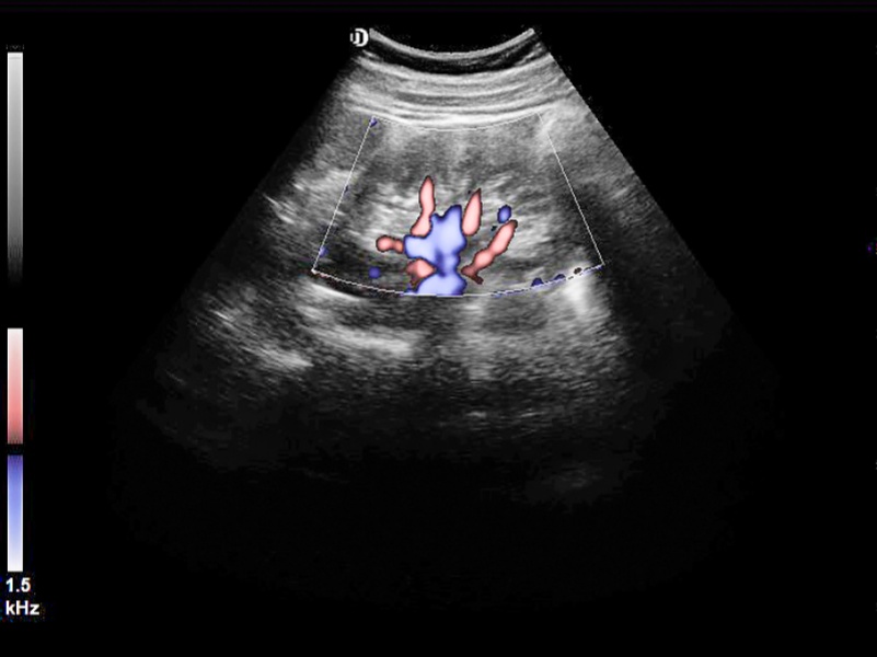 Retningskraft Doppler Imaging (DPDI)