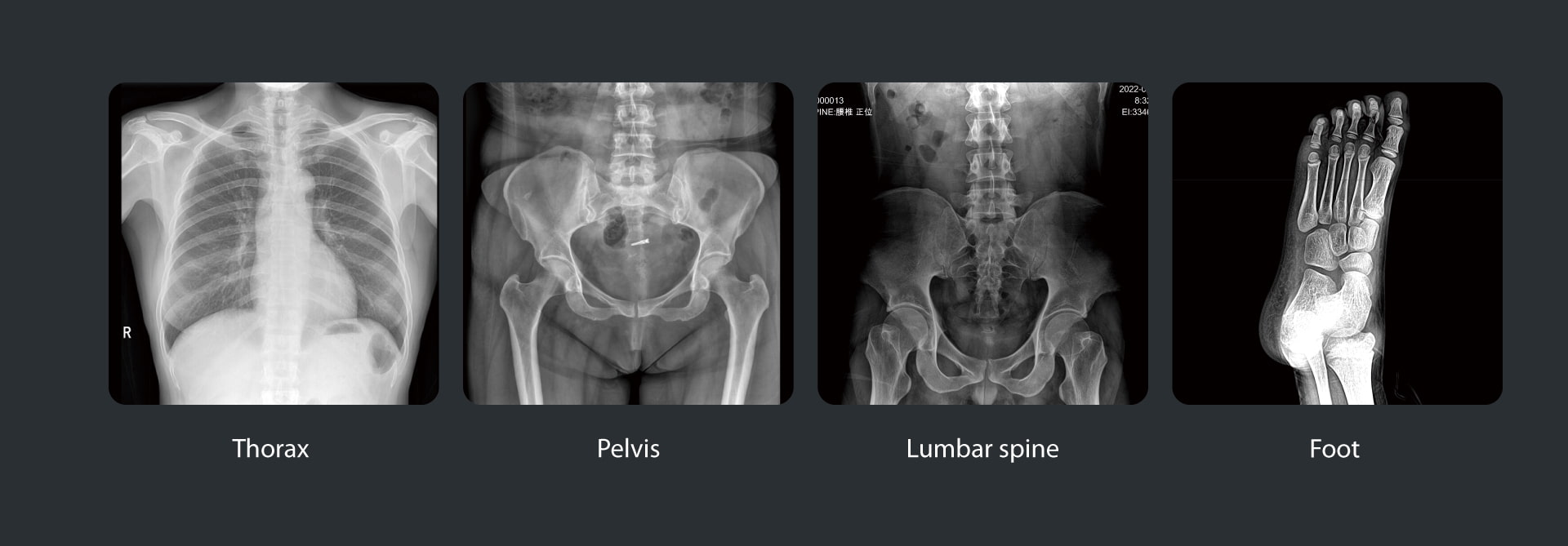 X-ray imaging