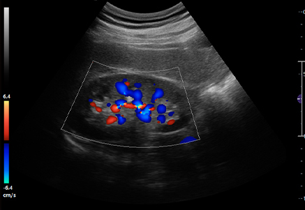 Kidney