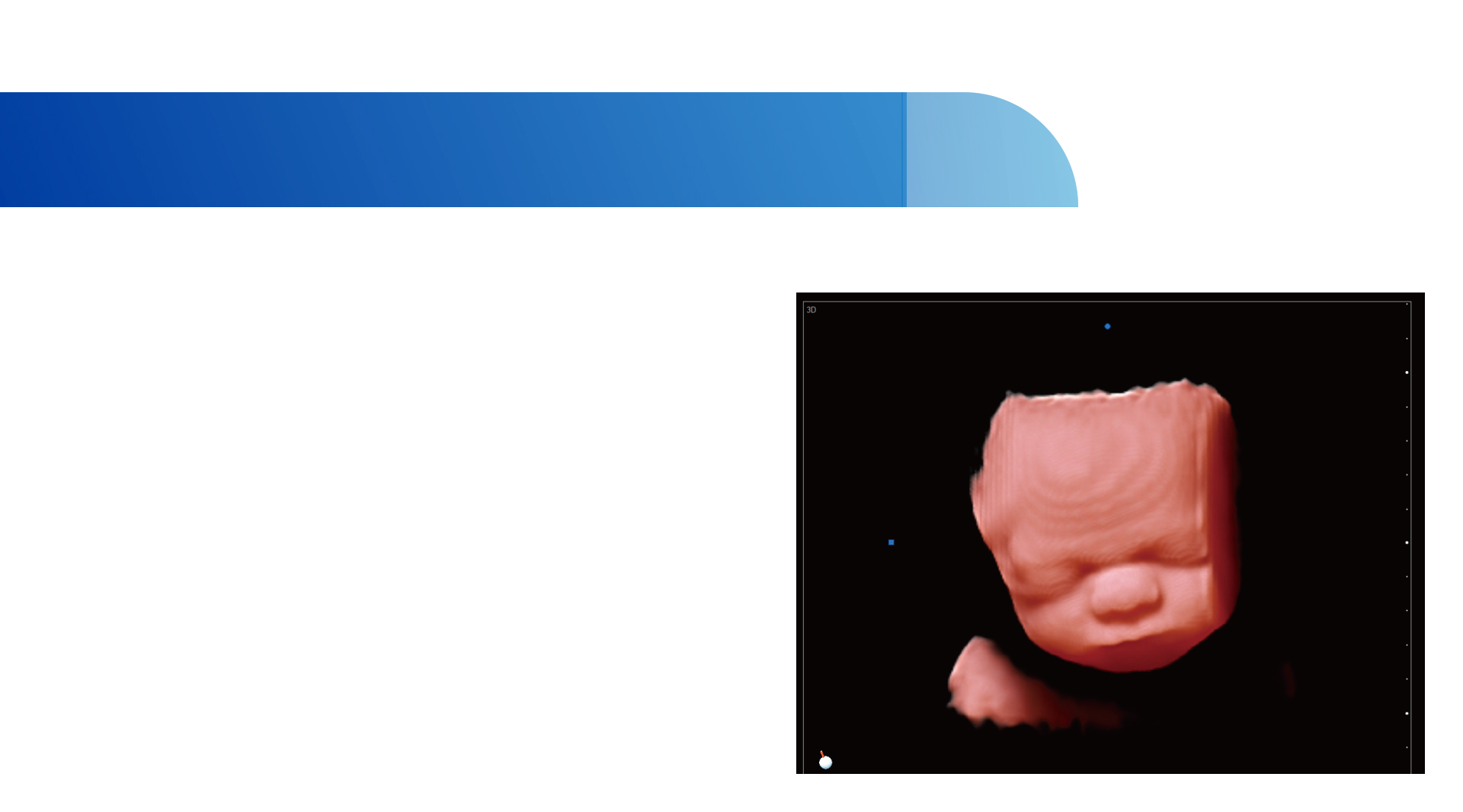 Freehand-3D-Imaging