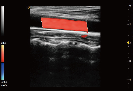 Tissue Harmonic Imaging (THI)