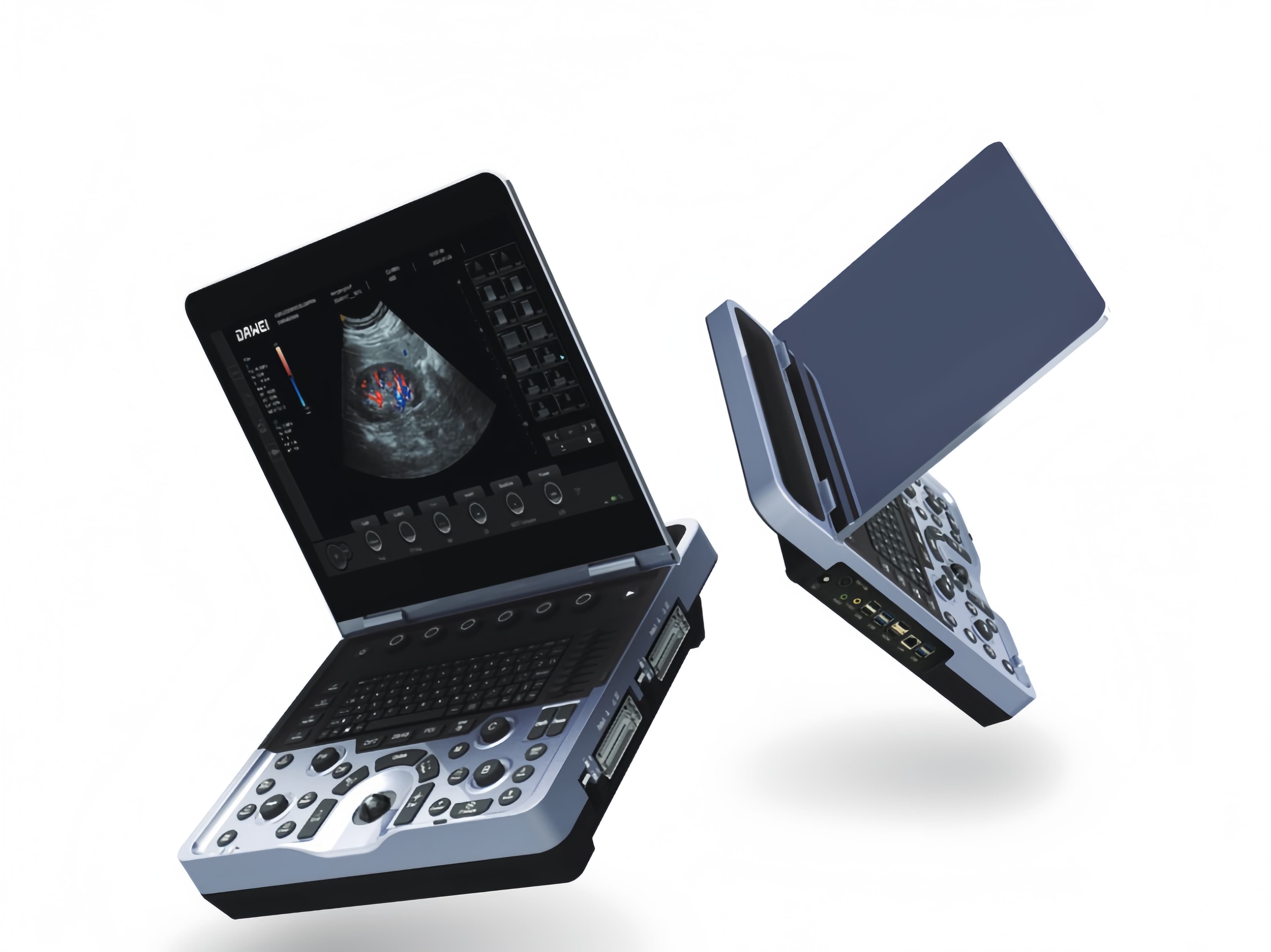 bærbar farve ultralyd maskine_image_repair _ 17472800086 12