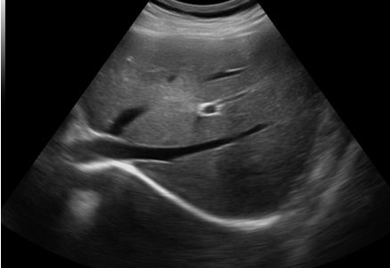 Liver