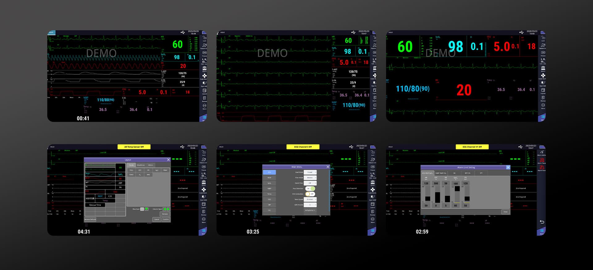 Modular Patient Monitor Features