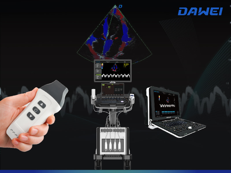 Breakthrough in Motion and Blood Flow Imaging Breakthrough in Motion and Blood Flow Imaging