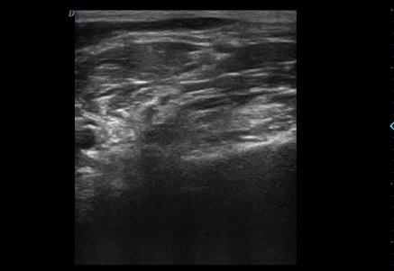 Musculoskeletal (MSK)