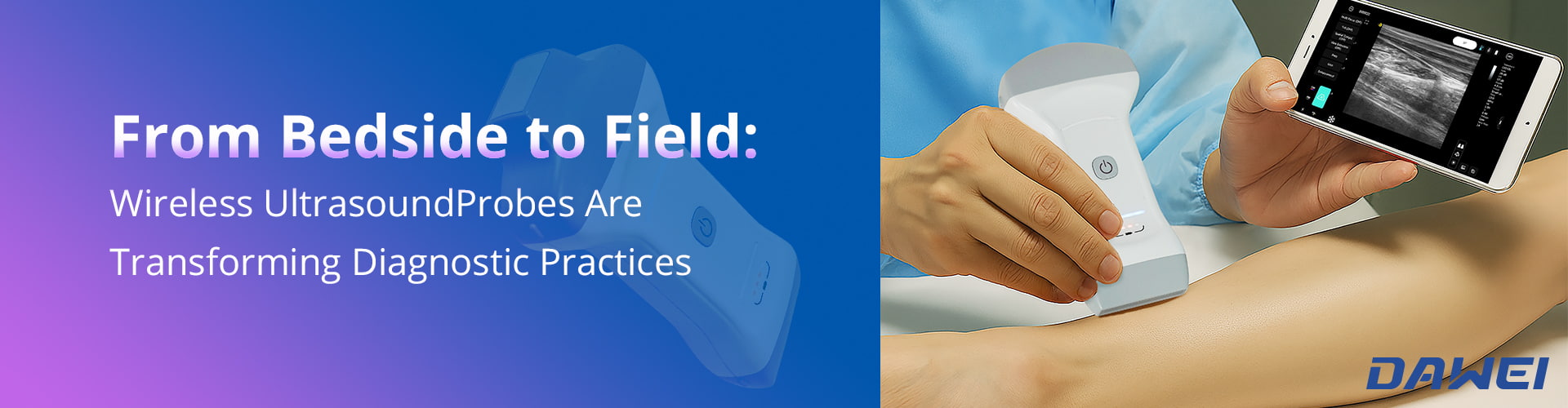 From Bedside To Field How Wireless Ultrasound Probes Are Transforming Diagnostic Practices From Bedside To Field How Wireless Ultrasound Probes Are Transforming Diagnostic Practices