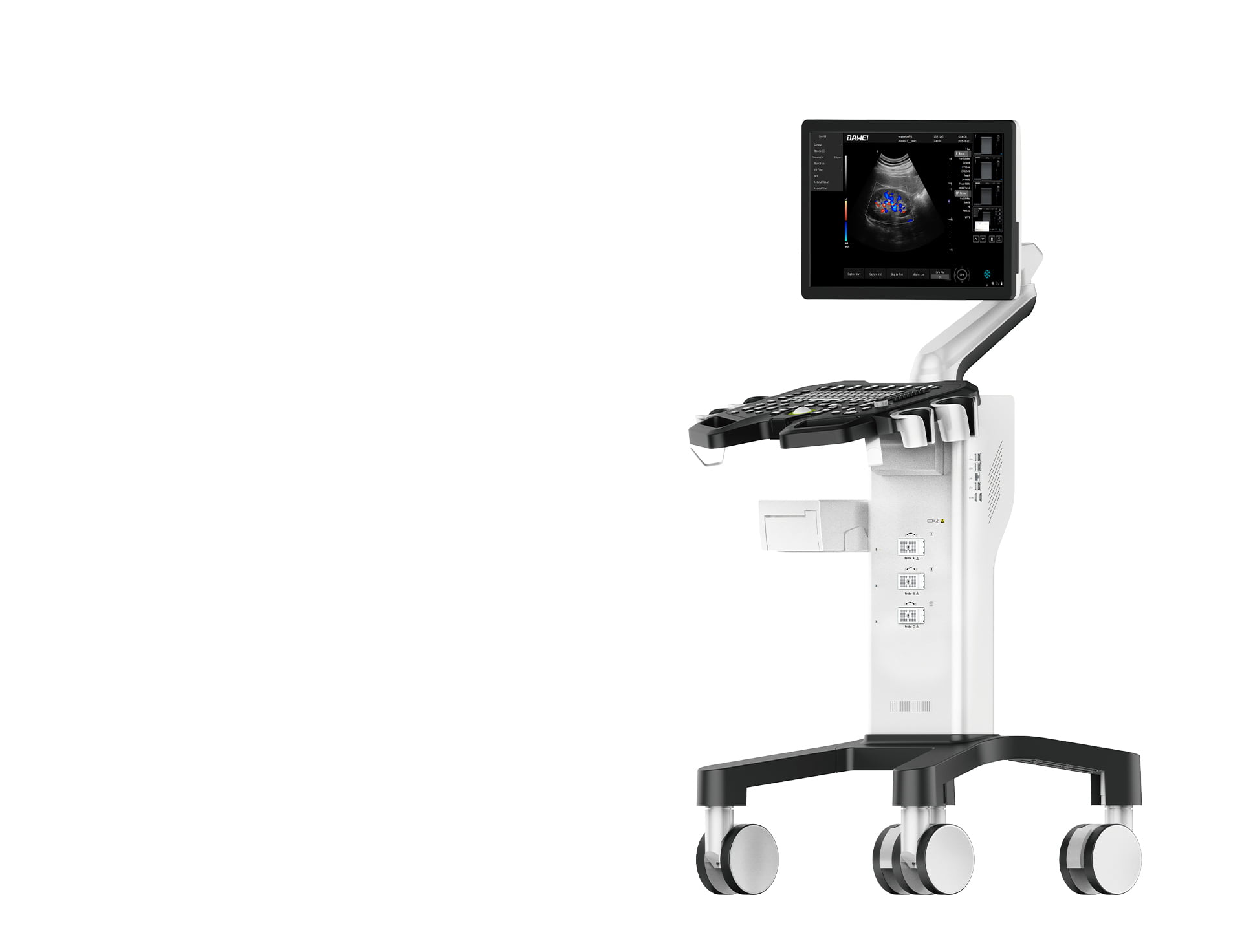 sonogram-machine