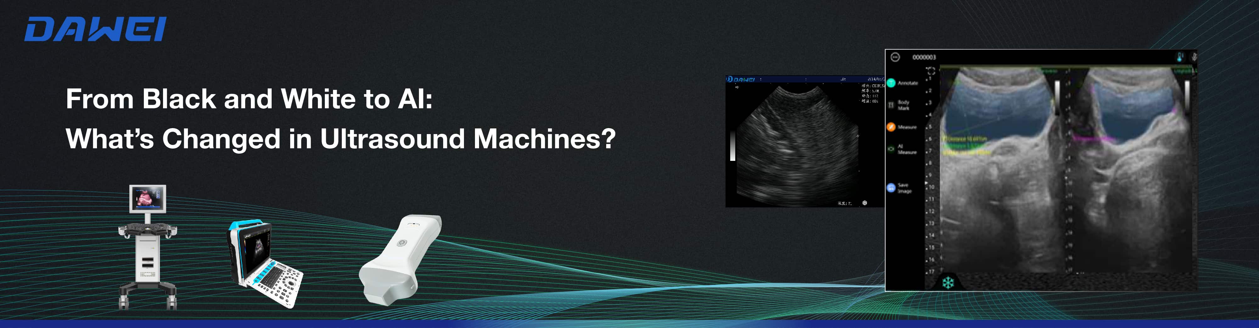 From Black and White to AI What’s Changed in Ultrasound Machines From Black and White to AI What’s Changed in Ultrasound Machines