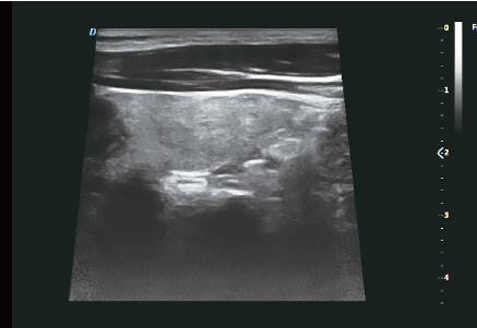 Trapezoid Imaging