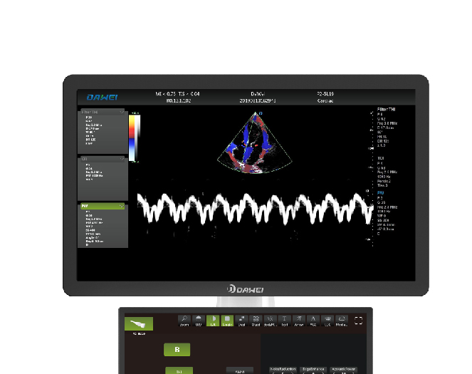 21.5 inch medical HD display