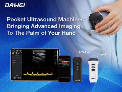 Pocket Ultrasound Machines Bringing Advanced Imaging To The Palm of Your Hand800-600.jpg