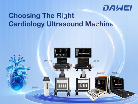 Choosing The Right Cardiology Ultrasound Machine Key Factors for Accurate Cardiac Imaging 800 600.jpg