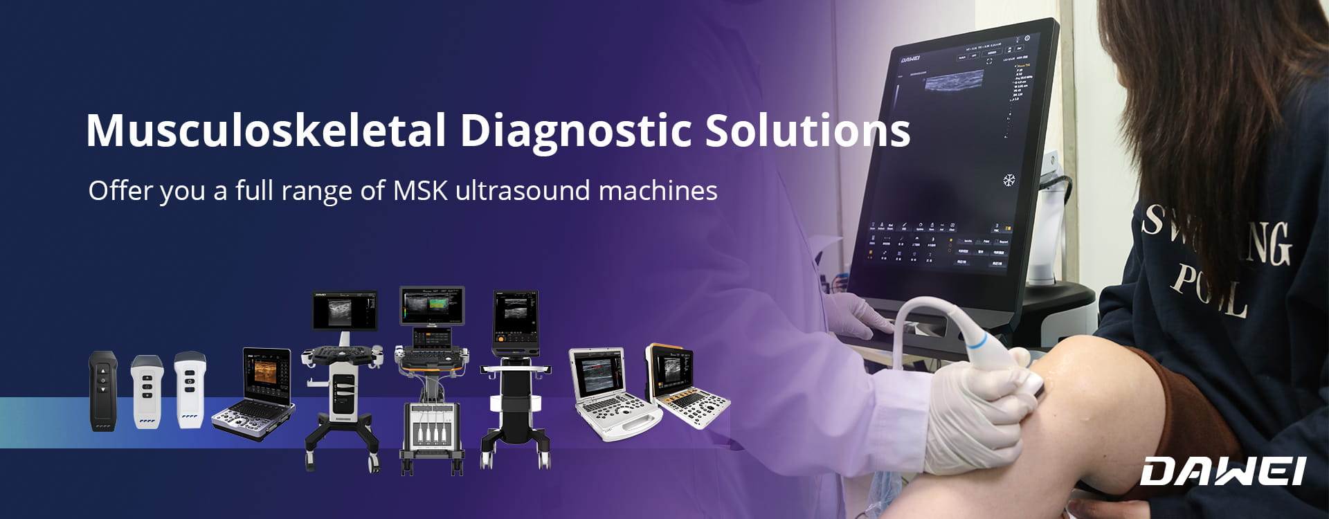 Dawei Medical MSK Ultrasound - Penyelesaian Diagnostik Musculoskeletal yang Komprehensif dan Tinggi