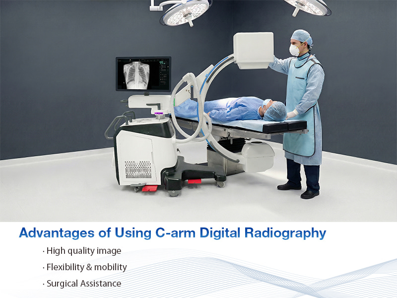 advantages of using C-arm digital radiography