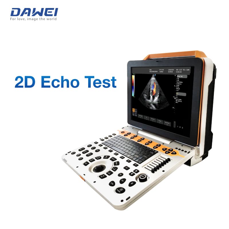 3D 4D tragbare Farbdoppler -Ultraschallmaschine