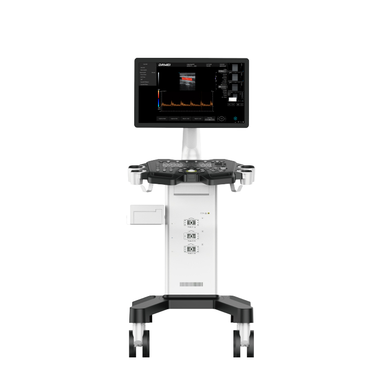 Cheap Trolley Color Doppler Ultrasound Equipment