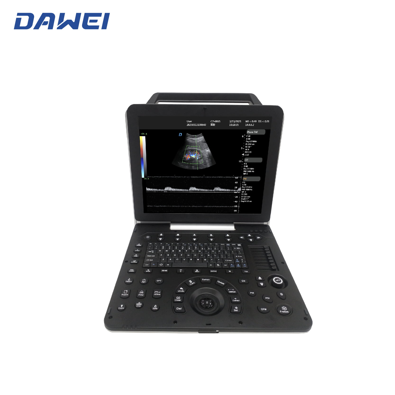 Cheap Portable 3D 4D Ultrasound Machine