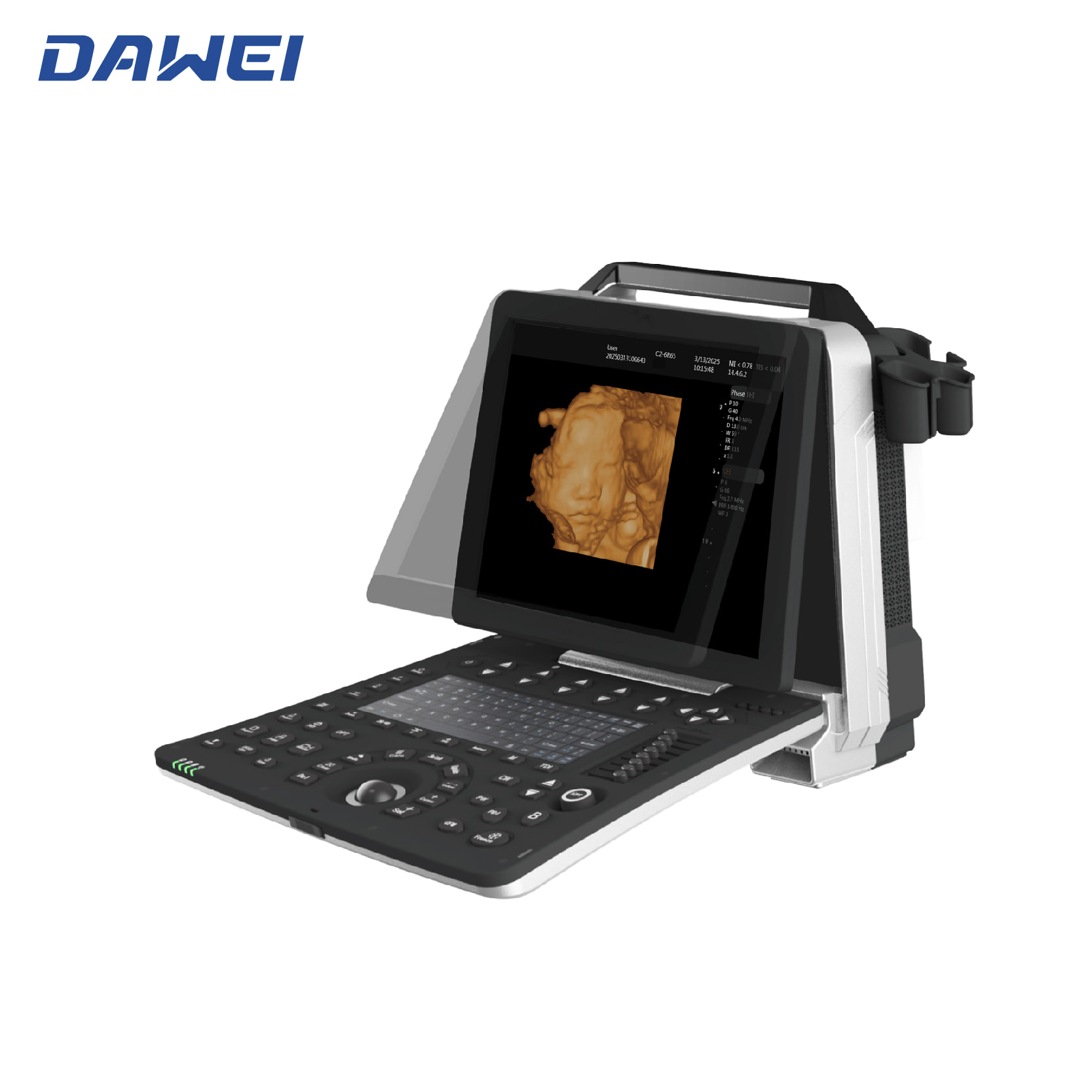 Cheap Portable 3D 4D Ultrasound Machine