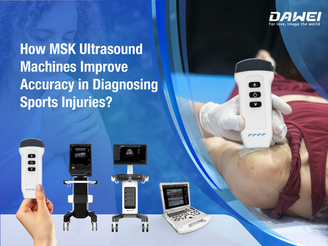 How MSK Ultrasound Machines Improve Accuracy in Diagnosing Sports Injuries-1920-720 (2).jpg