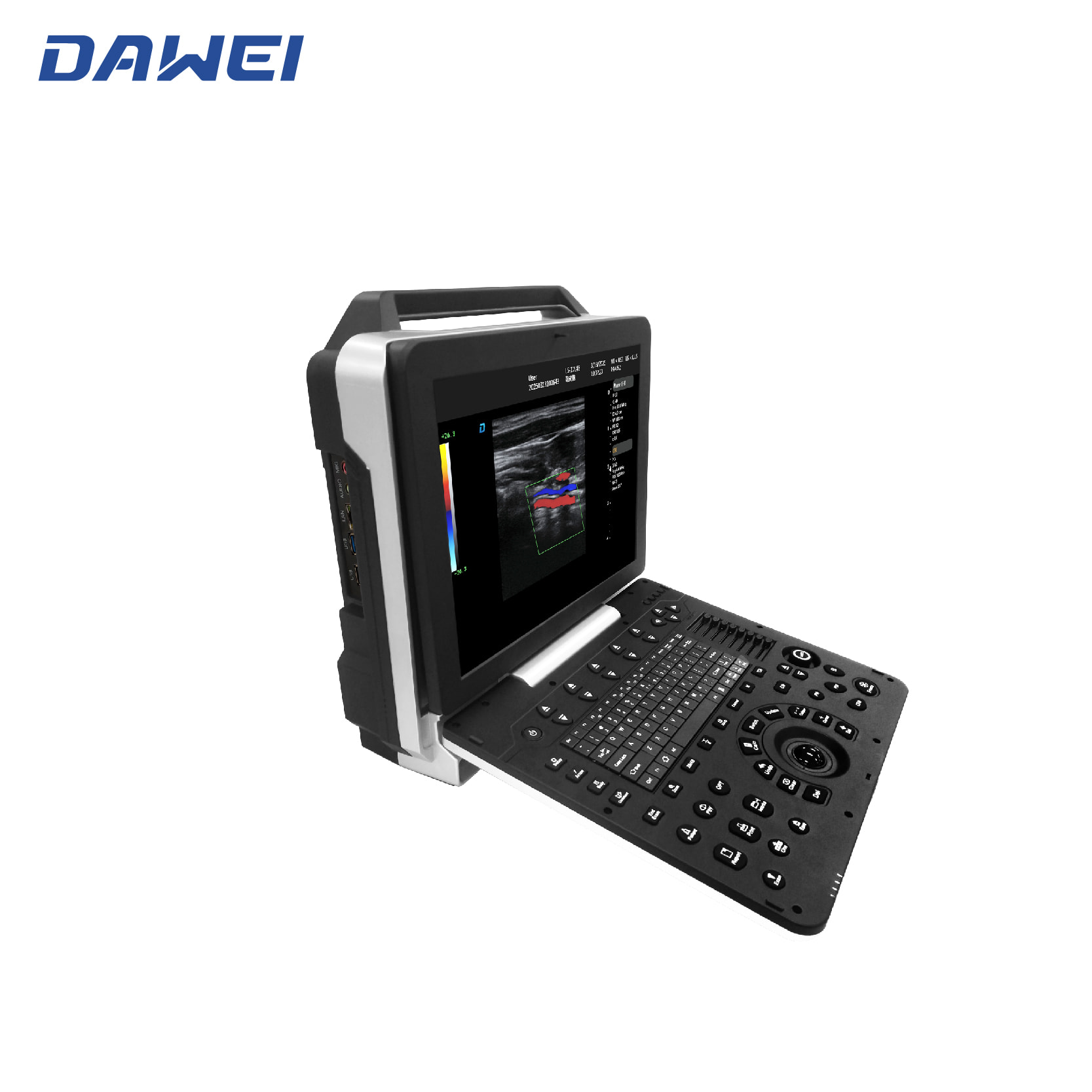 Cheap Portable 3D 4D Ultrasound Machine