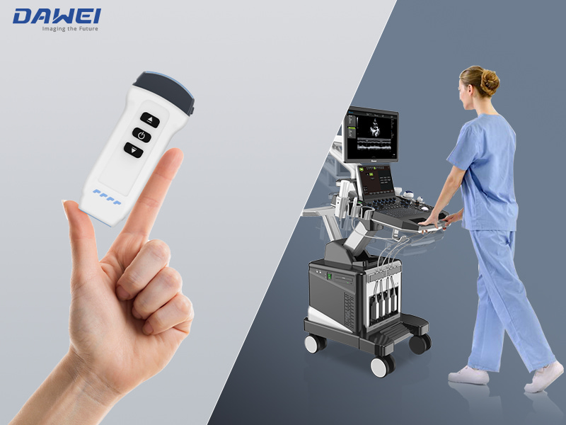 Pocket vs Cart-Based Choosing a Portable Ultrasound for Anesthesia.jpg