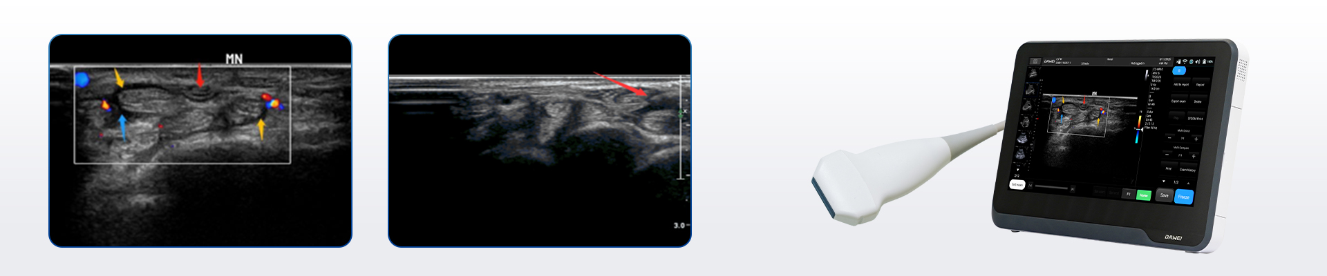 Ultrasound-guided Solutions