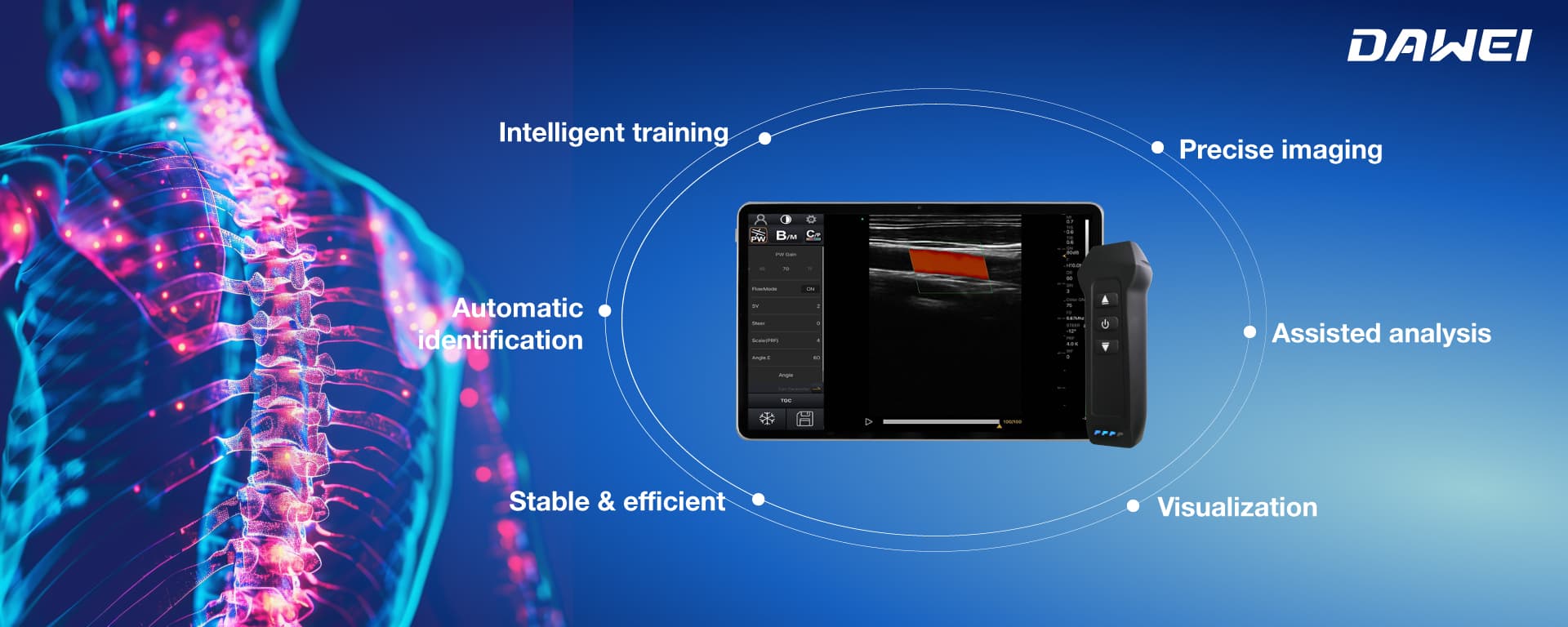 AI drive ultrasound machine