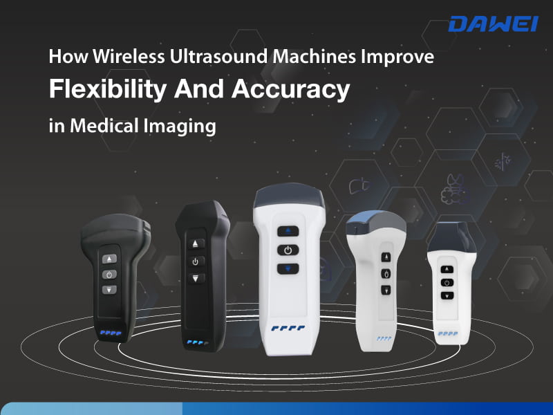 Bagaimana mesin ultrasound tanpa wayar meningkatkan fleksibiliti dan ketepatan dalam pengimejan perubatan-800-600.jpg
