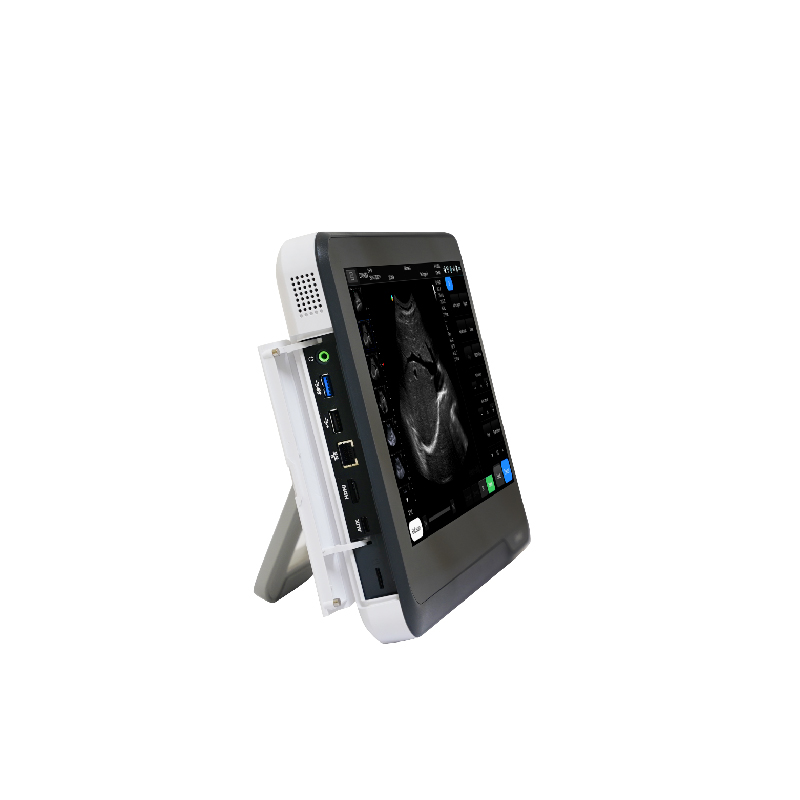 Portable Touchscreen Ultrasound Machine