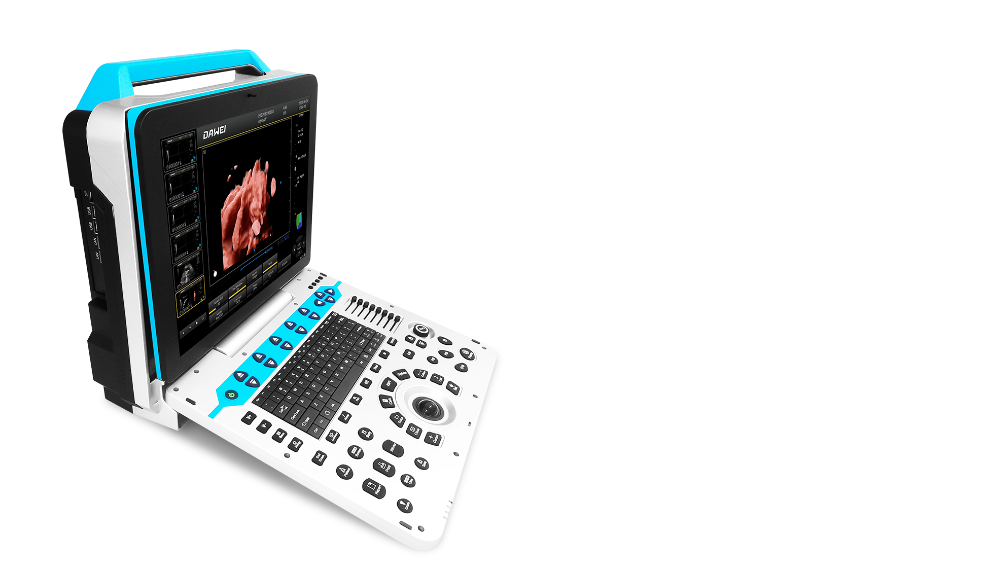 basic color ultrasound machine