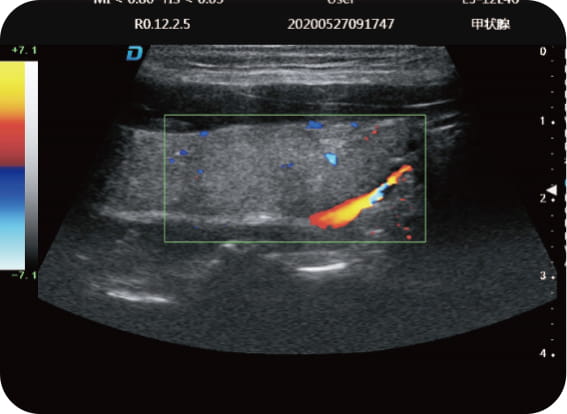 Imaging trapezoidale
