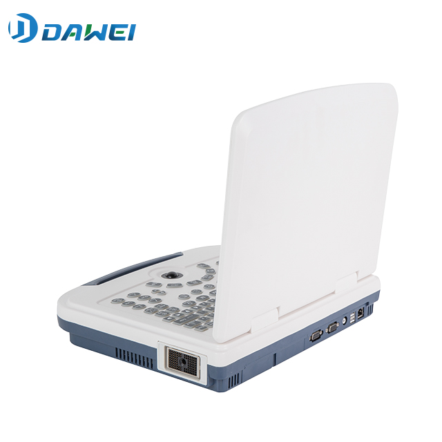Laptop Type B/W Ultrasound System with Low Price