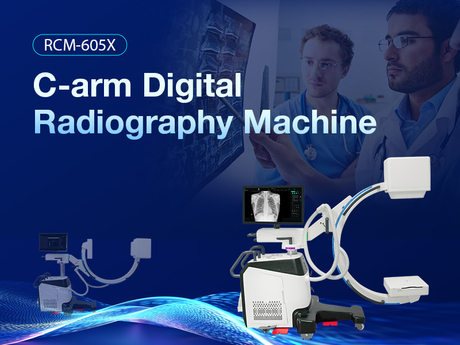 What Is The C-arm Digital Radiography Machine 800 600.jpg