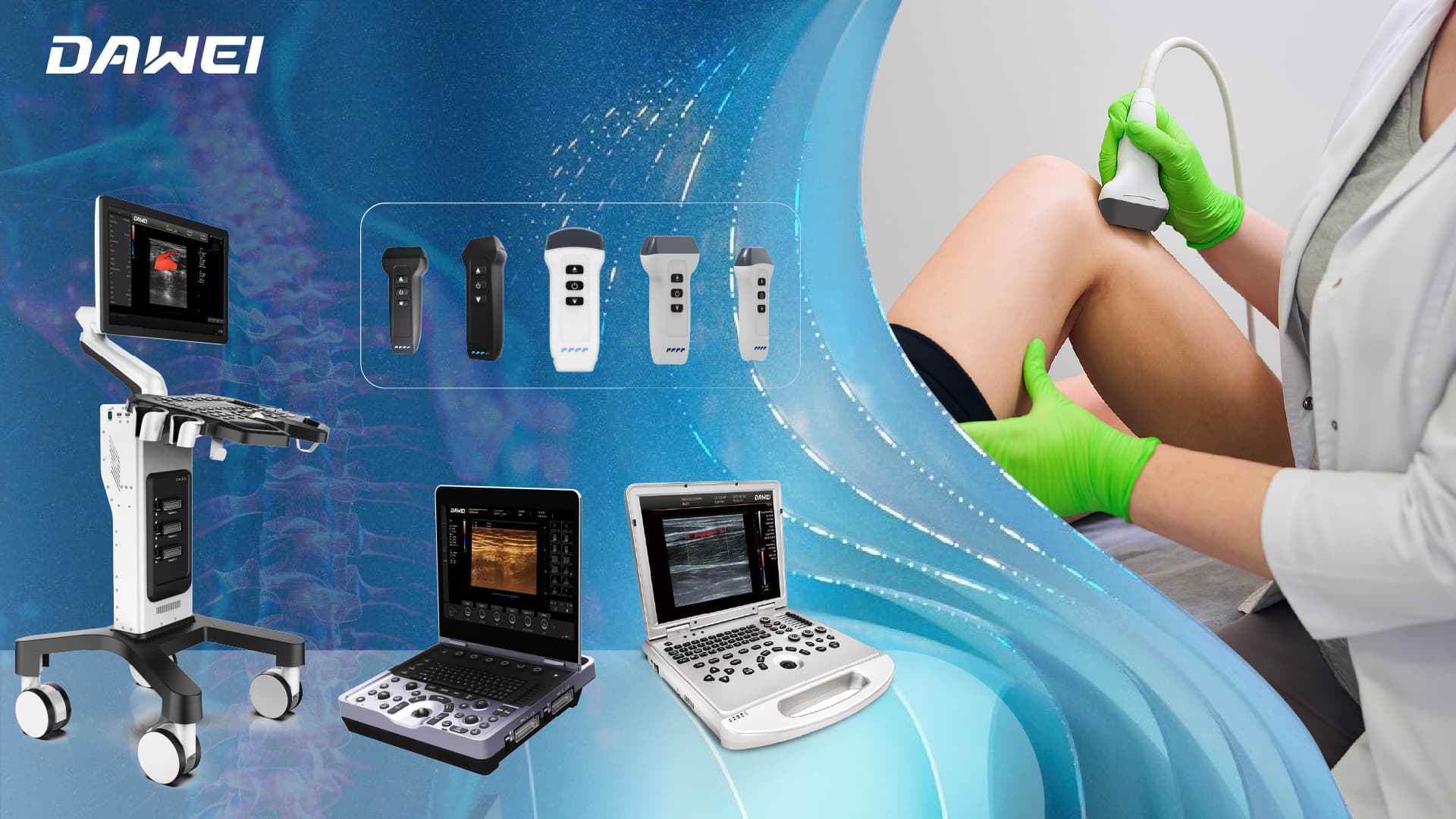 Máy siêu âm MSK cho phép nhanh hơn, chẩn đoán MSK an toàn hơn １.jpg