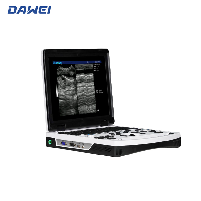 Prijenosni crno-bijeli ultrazvučni dijagnostički sustav