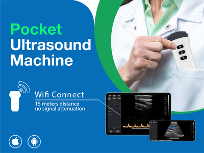 5.23 best handheld ultrasound machine800 600.jpg