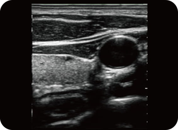 Imaging composto spaziale