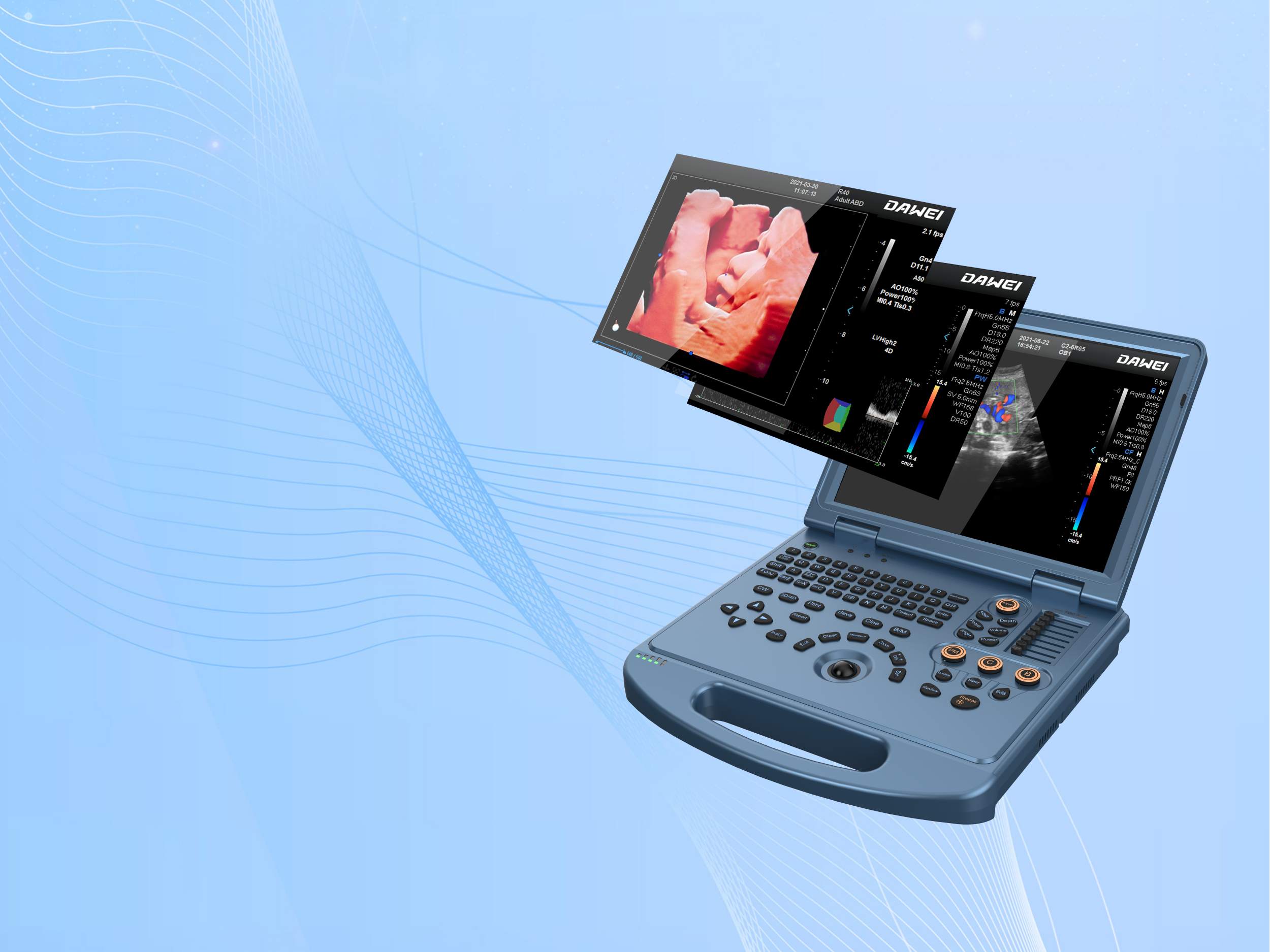 portable-4D-color-ultrasound-machine