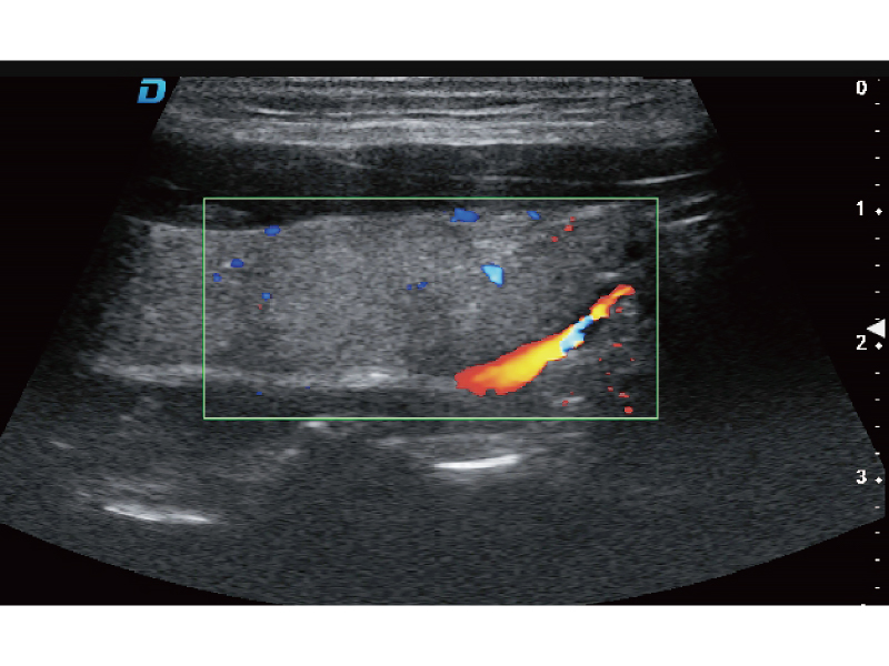 Trapezoidal imaging