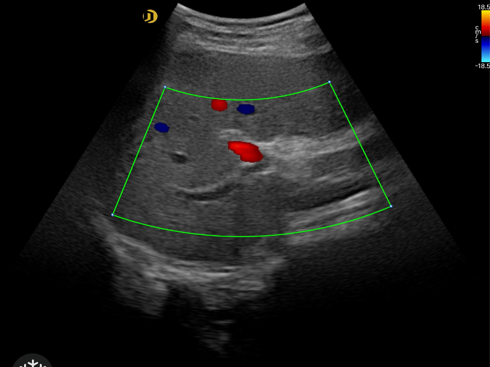 Convex Imaging