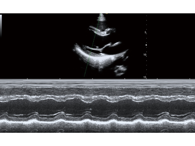 Anatomic M Mode