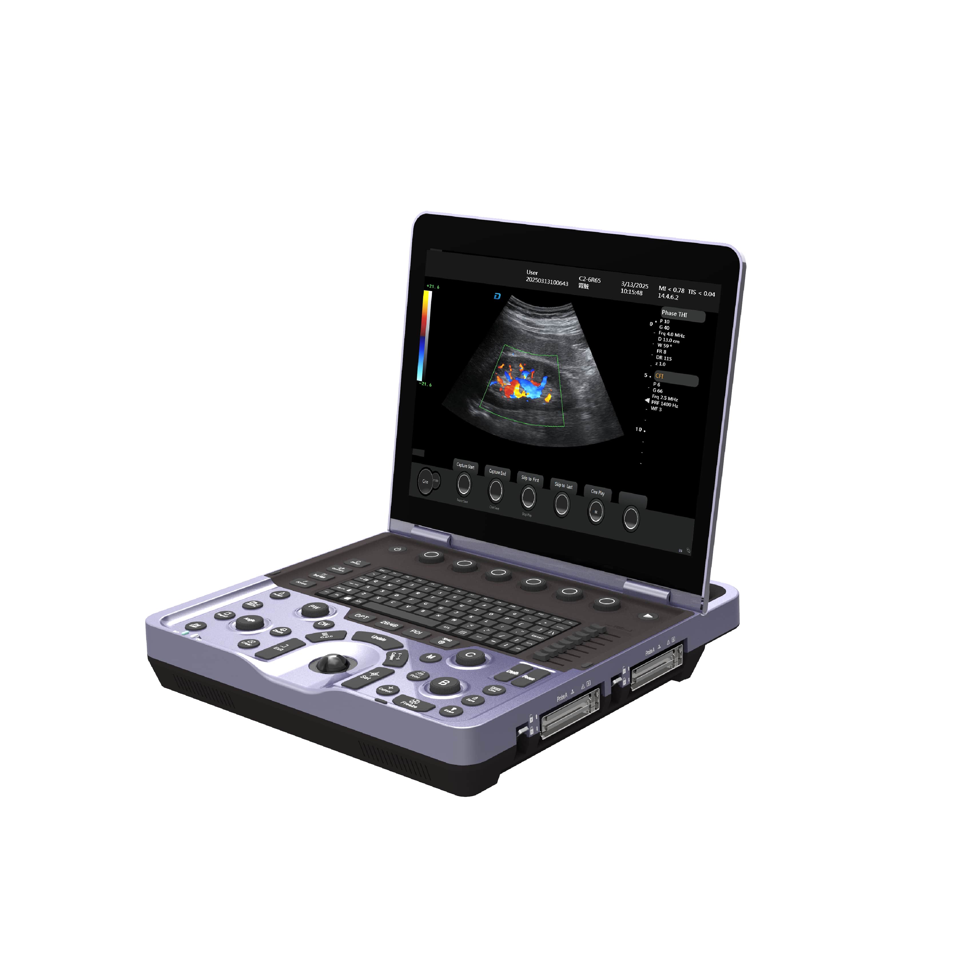 Laptop Color Doppler Ultrasound System