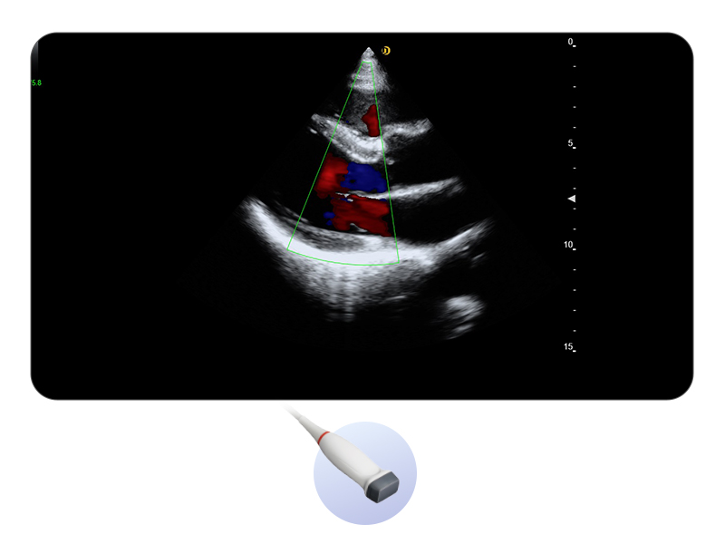 Cardiology