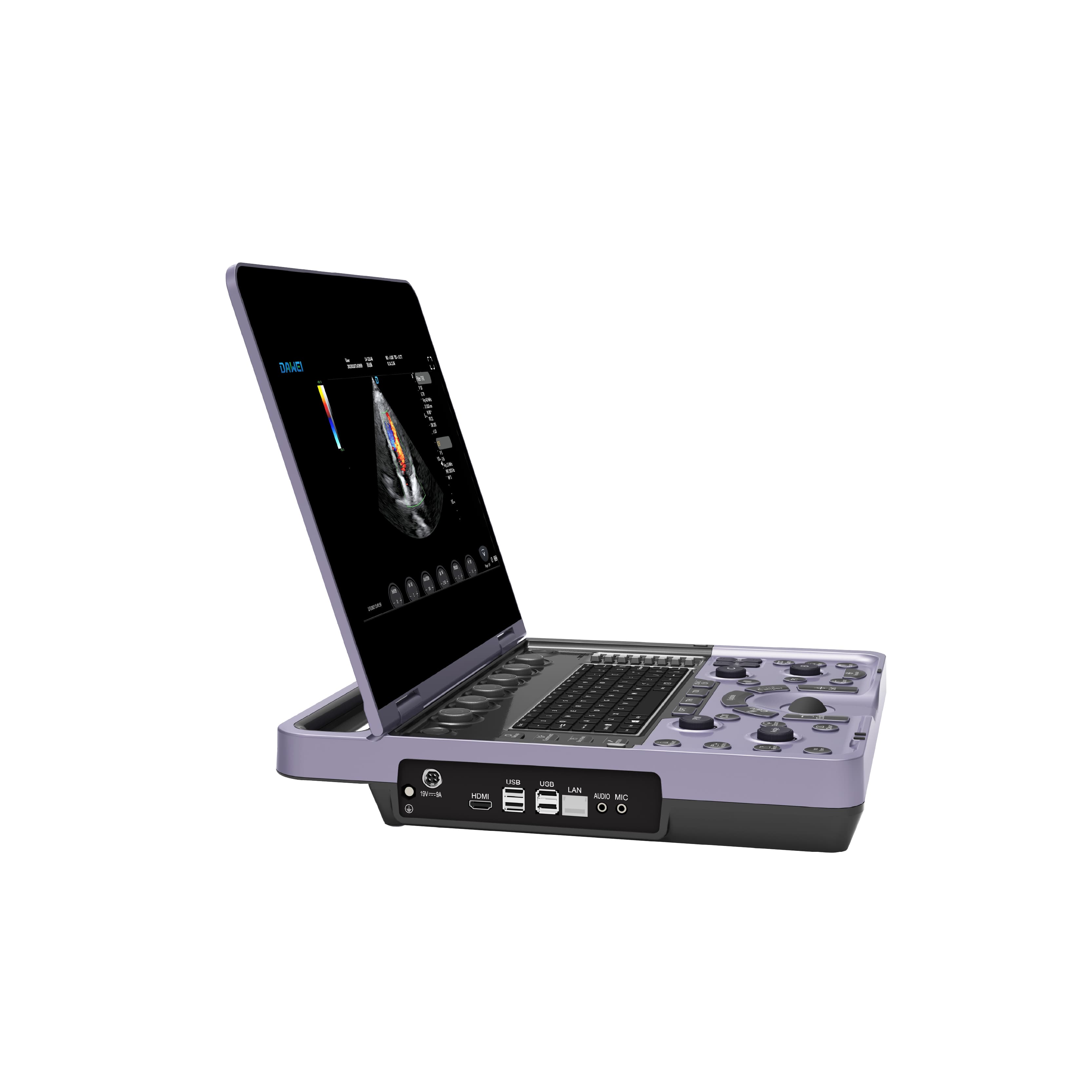 Laptop Color Doppler Ultrasound System