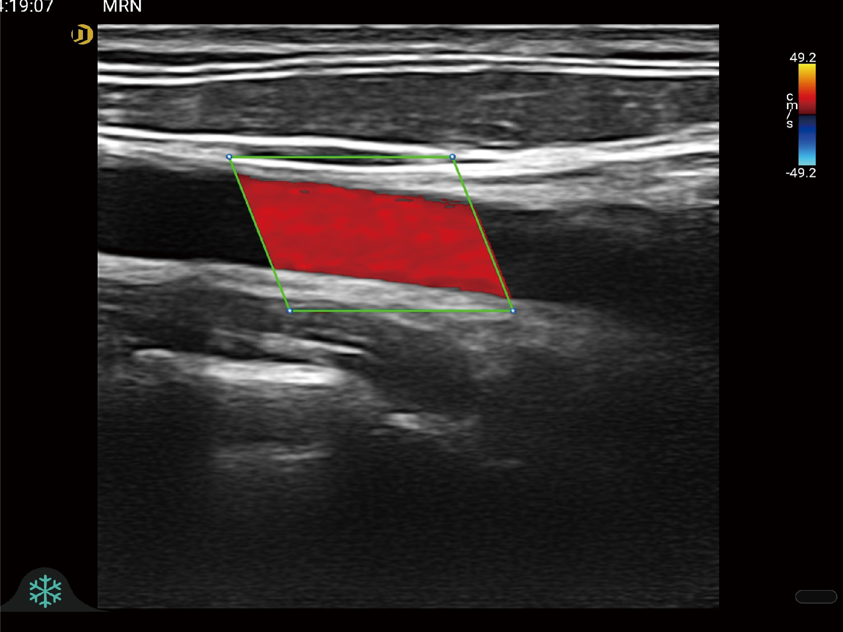 Linear Imaging
