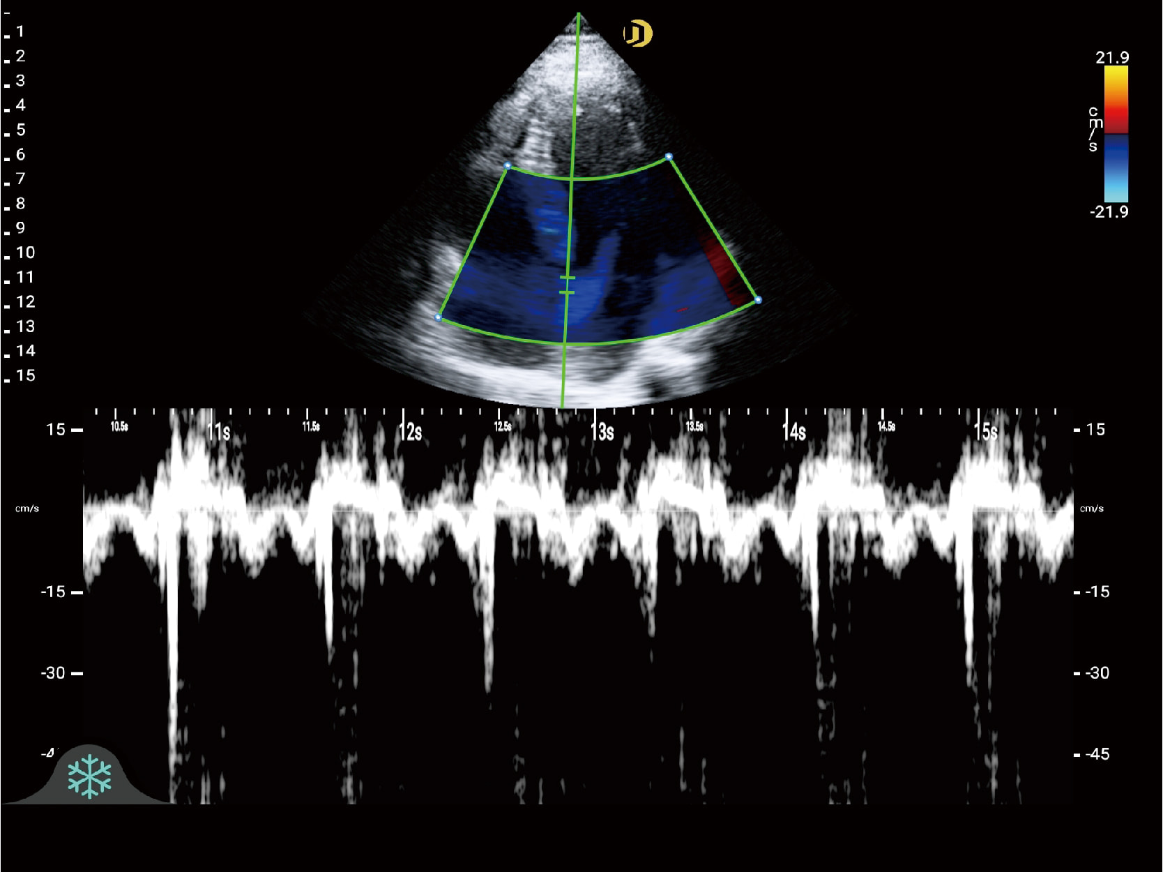Cardiac Imaging