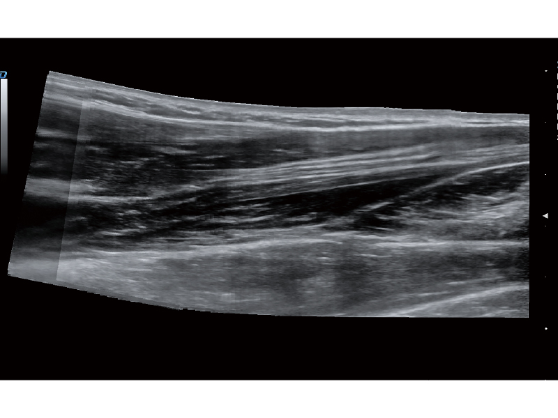 Panoramic Imaging