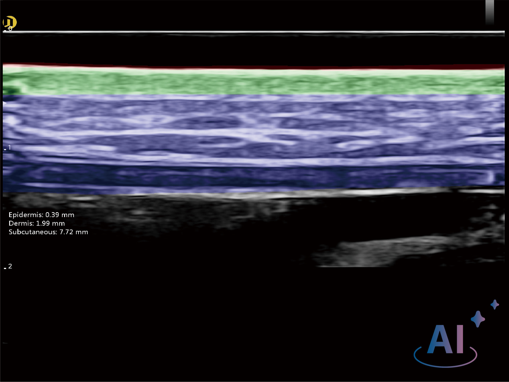 Facial Skin Analysis