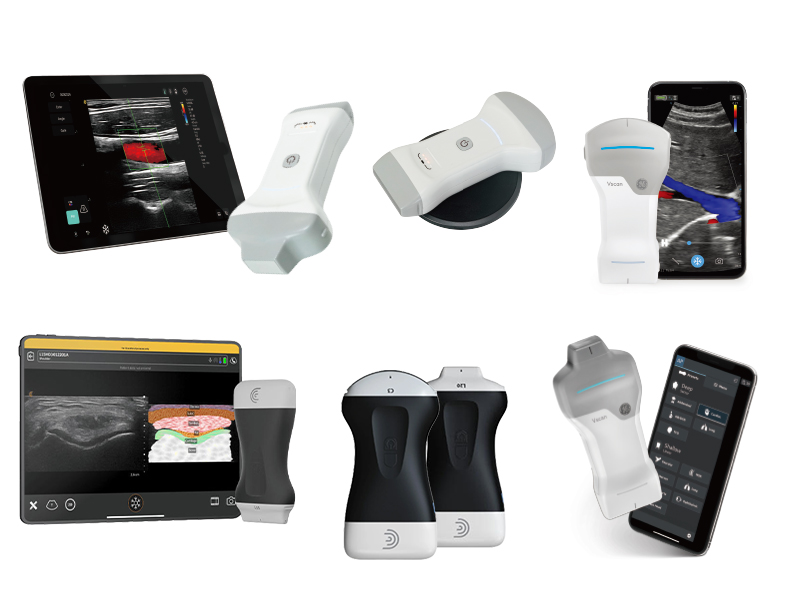 Dawei C3.0 Series vs. GE Vscan Air vs. Clarius HD3.jpg